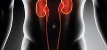 Learning lessons from urology claims image